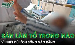Nhét đùi ếch sống vào răng, người phụ nữ 61 tuổi bị sán ký sinh, làm tổ trong não