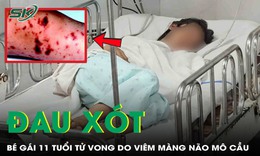Đau xót: Bé gái 11 tuổi tử vong do viêm màng não mô cầu thể tối cấp