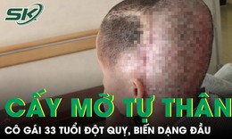 Cấy mỡ tự thân, cô gái 33 tuổi đột quỵ, biến dạng đầu