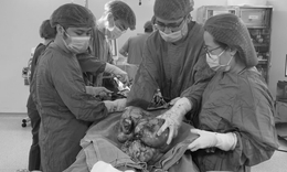 Người phụ nữ chịu đau âm ỉ vùng bụng suốt 6 tháng, đến viện, bác sĩ 'lấy ra' khối u sarcoma tử cung gần 9kg