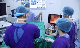 Cách tán sỏi thận không sẹo mổ