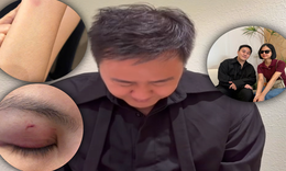 Trung Quân Idol đăng video xin lỗi vợ chồng bác sĩ Phạm Minh Trường
