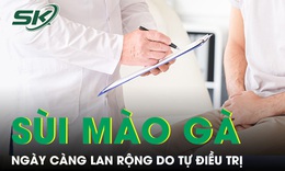 Nam thanh niên 18 tuổi mắc sùi mào gà lan rộng vì tự điều trị sai cách