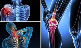 Không vận động mạnh tại sao vẫn bị thoái hoá?