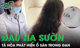 Phát hiện ổ sán làm tổ trong gan từ dấu hiệu đau hạ sườn phải kéo dài 