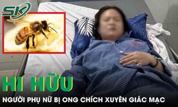 Ong chích xuyên giác mạc, người phụ nữ sưng phù mắt phải cấp cứu khẩn