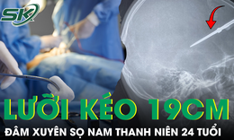Cứu nam thanh niên 24 tuổi bị lưỡi kéo dài 19 cm đâm xuyên sọ não
