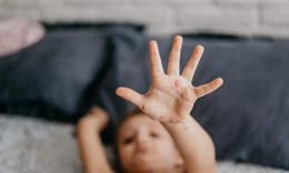 Mắc thủy đậu, sau bao lâu trẻ có thể đi học trở lại?