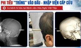 Người đàn ông bị phi tiêu cắm trúng đầu nhập viện khẩn cấp
