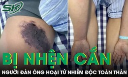 Người đàn ông bị nhện cắn hoại tử nhiễm độc toàn thân