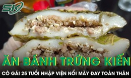 Ăn bánh trứng kiến theo trào lưu, cô gái 25 tuổi nhập viện nổi mày đay toàn thân 