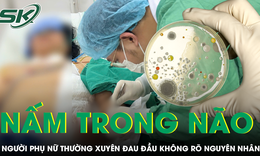 Đau đầu nhiều ngày, người phụ nữ bất ngờ phát hiện nấm nguy hiểm trong não