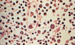Tỷ lệ tử vong do nhiễm virus Hanta tăng cao, Chile nâng mức cảnh báo y tế