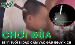 Hai anh em chơi đùa tại nhà, bé 11 tuổi bị dao cắm vào đầu nguy kịch