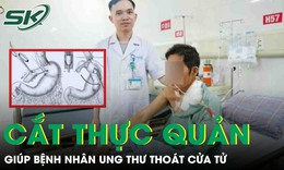 Người đàn ông phải cắt thực quản để điều trị ung thư