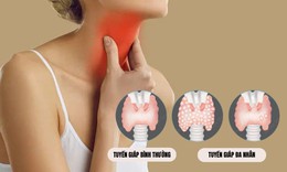 Những bệnh tuyến giáp ngày càng phổ biến trong cộng đồng