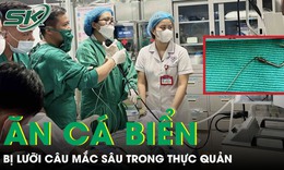 Hiếm gặp: Ăn cá biển, người đàn ông bị lưỡi câu mắc sâu trong thực quản