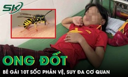 Ong vò vẽ đốt 70 vết, bé gái 10 tuổi sốc phản vệ, suy đa cơ quan phải cấp cứu gấp