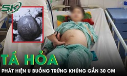 Tá hoả phát hiện khối u buồng trứng ‘cực khủng’ gần 30cm từ dấu hiệu đau bụng