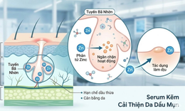 Serum kẽm: 'Chìa khóa' kiểm soát dầu nhờn và giải quyết bài toán mụn viêm