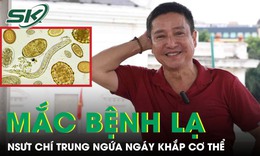 NSƯT Chí Trung mắc bệnh lạ, cơ thể đỏ như 'tôm luộc'