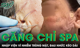 Căng chỉ nâng cơ ở spa, người phụ nữ nhập viện vì nhiễm trùng mặt