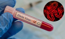 TPHCM tăng cường giám sát trước nguy cơ dịch Ebola xâm nhập