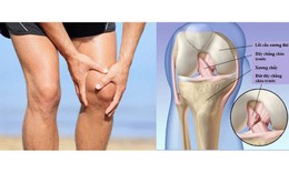 Đau khớp gối khi leo cầu thang có đáng lo?