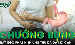 Chướng bụng kéo dài, người phụ nữ 48 tuổi bất ngờ phát hiện ung thư dạ dày di căn