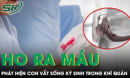 Ho ra máu suốt một tháng, bàng hoàng phát hiện con vắt sống ký sinh trong khí quản