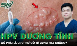 Có phải HPV dương tính là bị ung thư cổ tử cung không?