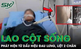 Đau lưng kéo dài nhưng chủ quan, người đàn ông bất ngờ liệt hai chân vì lao cột sống