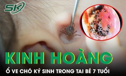 Kinh hoàng phát hiện ổ ve chó ký sinh trong tai bé trai 7 tuổi 