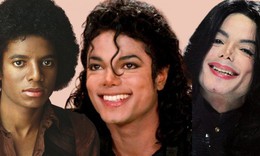 Sự thật về căn bệnh hiếm khiến Michael Jackson phải tẩy trắng da