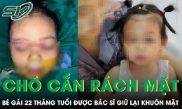 Xót xa bé gái 22 tháng tuổi bị chó cắn rách mặt 