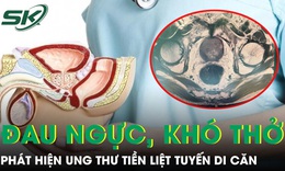 Phát hiện ung thư tiền liệt tuyến di căn từ triệu chứng đau ngực khó thở