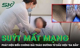 Tưởng da bẩn, cô gái 20 tuổi suýt mất mạng vì biến chứng đái tháo đường