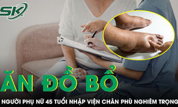 Ăn liên tục đồ bổ thận, người phụ nữ 45 tuổi nhập viện, chân phù nghiêm trọng