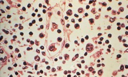 Đài Loan (Trung Quốc) ghi nhận 1 ca tử vong do nhiễm virus Hanta