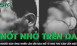 Chủ quan với nốt nhỏ trên da, người đàn ông nhiều lần phẫu thuật ung thư xâm lấn tái phát