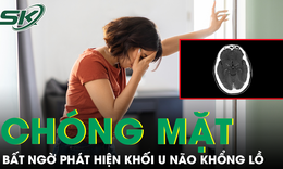 Chóng mặt xây xẩm, người phụ nữ bất ngờ phát hiện khối u não khổng lồ