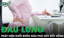 Đau lưng kéo dài, người phụ nữ phát hiện khối bướu máu đã phá hủy gần toàn bộ đốt sống