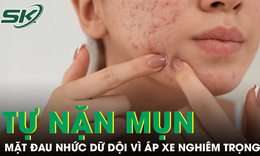 Tự nặn mụn quanh môi, cô gái nhập viện vì áp xe mặt, nhiễm vi khuẩn kháng thuốc