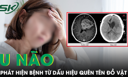 Liên tục quên tên đồ vật quen thuộc, người phụ nữ phát hiện khối u não nguy hiểm 