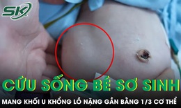 Cứu sống bé sơ sinh mang khối u khổng lồ nặng gần bằng 1/3 cơ thể