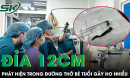 Bé 8 tuổi ho nhiều, bác sĩ phát hiện con đỉa dài hơn 12 cm trong đường thở