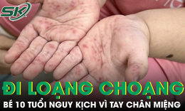Tưởng bệnh nhẹ, bé gái 10 tuổi nhập viện nguy kịch vì tay chân miệng biến chứng thần kinh