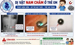 Bé gái 38 tháng tuổi nuốt phải nam châm và lời cảnh báo từ bác sĩ