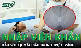 Người đàn ông nhập viện khẩn vì đầu vòi xịt mắc sâu trong trực tràng