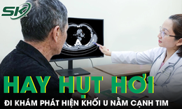 Hụt hơi kéo dài, người đàn ông đi khám phát hiện khối u nằm cạnh tim